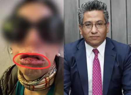 Llamado a la renuncia del gerente de EMAPA por denuncias de violencia
