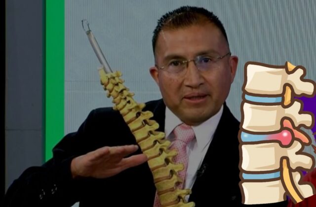 Identificando la hernia de disco: síntomas y recomendaciones