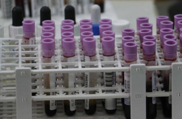 Inteligencia artificial y aprendizaje automático: herramientas para detectar riesgo de cáncer